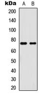 Polyclonal Rabbit anti-Human RELA / NFKB p65 Antibody (phospho-Thr254, IHC, WB)