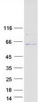 Human UGT3A1 Protein (Recombinant Myc-DDK (Flag))
