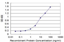 SLC2A4 / GLUT-4 Antibody (clone 2A4)