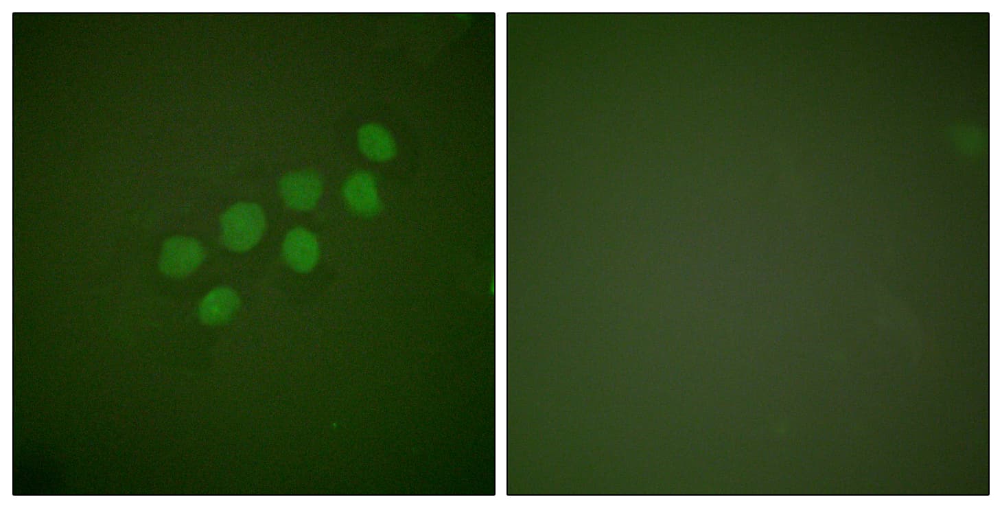 SKP2 Antibody (aa366-415)