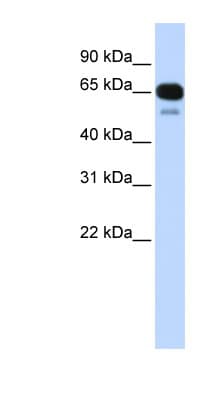 SLC22A8 / OAT3 Antibody (C-Terminus)