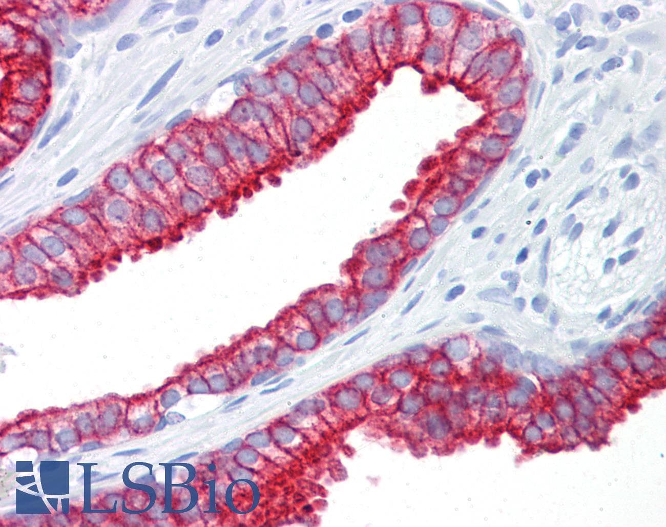 IHC-plus™ KRT8 / CK8 / Cytokeratin 8 Antibody (clone M20)