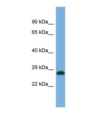 PRUNE Antibody (C-Terminus)