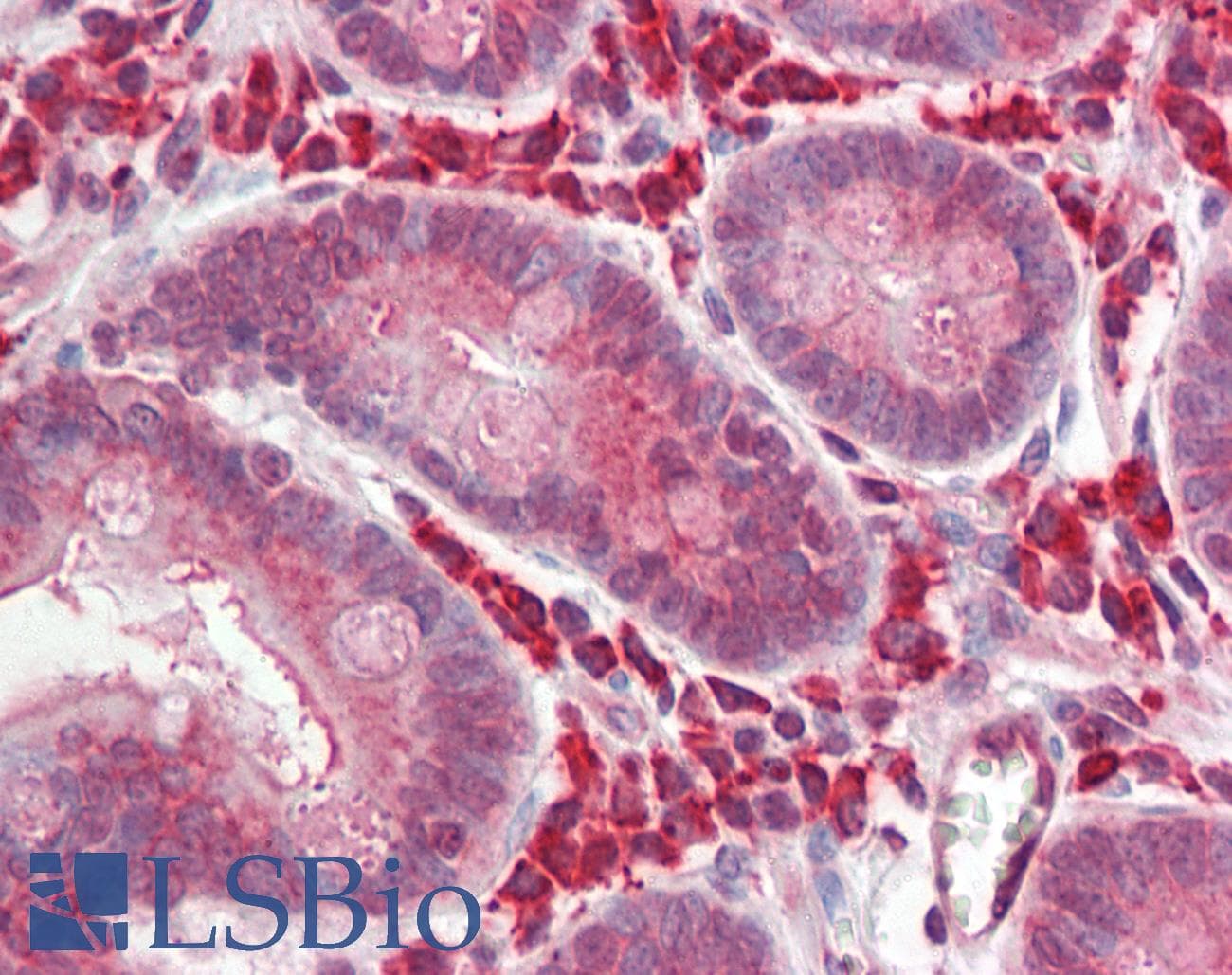 IHC-plus™ BCL3 / BCL-3 Antibody (aa2-13)