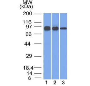 CTNNB1 / Beta Catenin Antibody (clone 12F7)