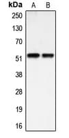 Polyclonal Rabbit anti-Human BMP3 Antibody (Internal, WB)