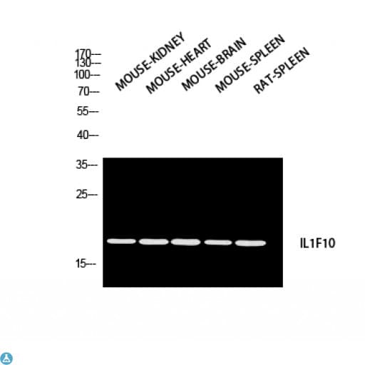 Polyclonal Rabbit anti-Human IL1F10 Antibody (IHC, WB)