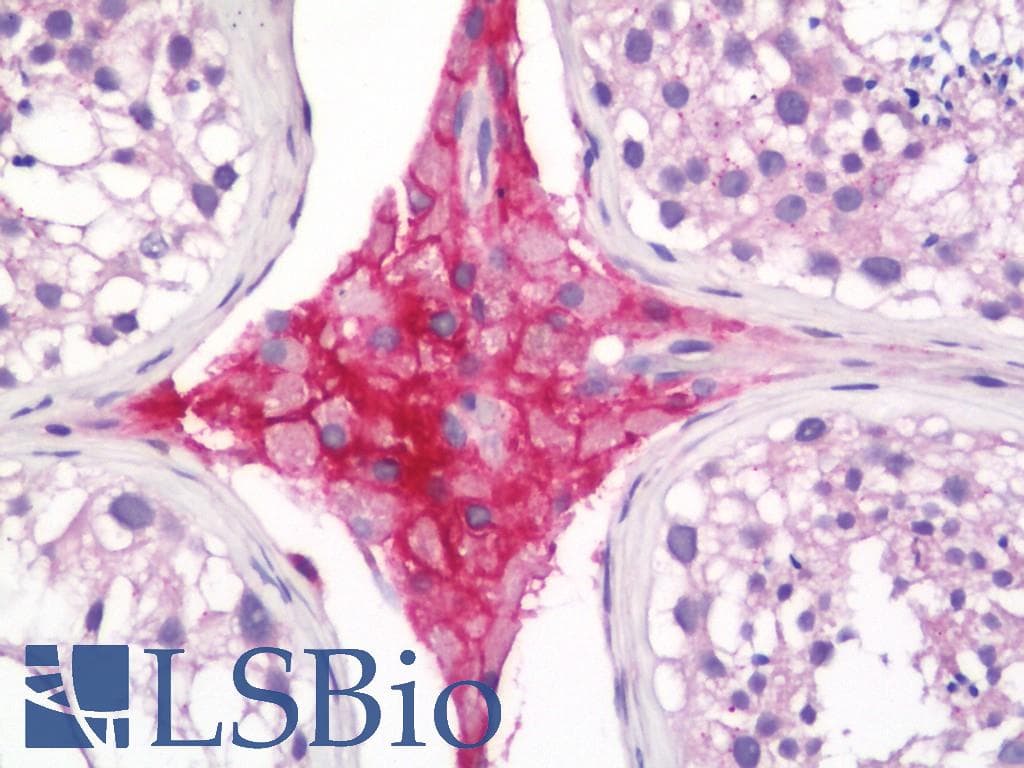 IHC-plus™ Monoclonal Rabbit anti-Human Betaglycan / TGFBR3 Antibody (clone D11G10, Extracellular Domain, IHC, WB)