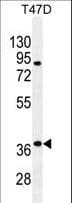 PSMB11 / BETA5T Antibody (aa250-278)
