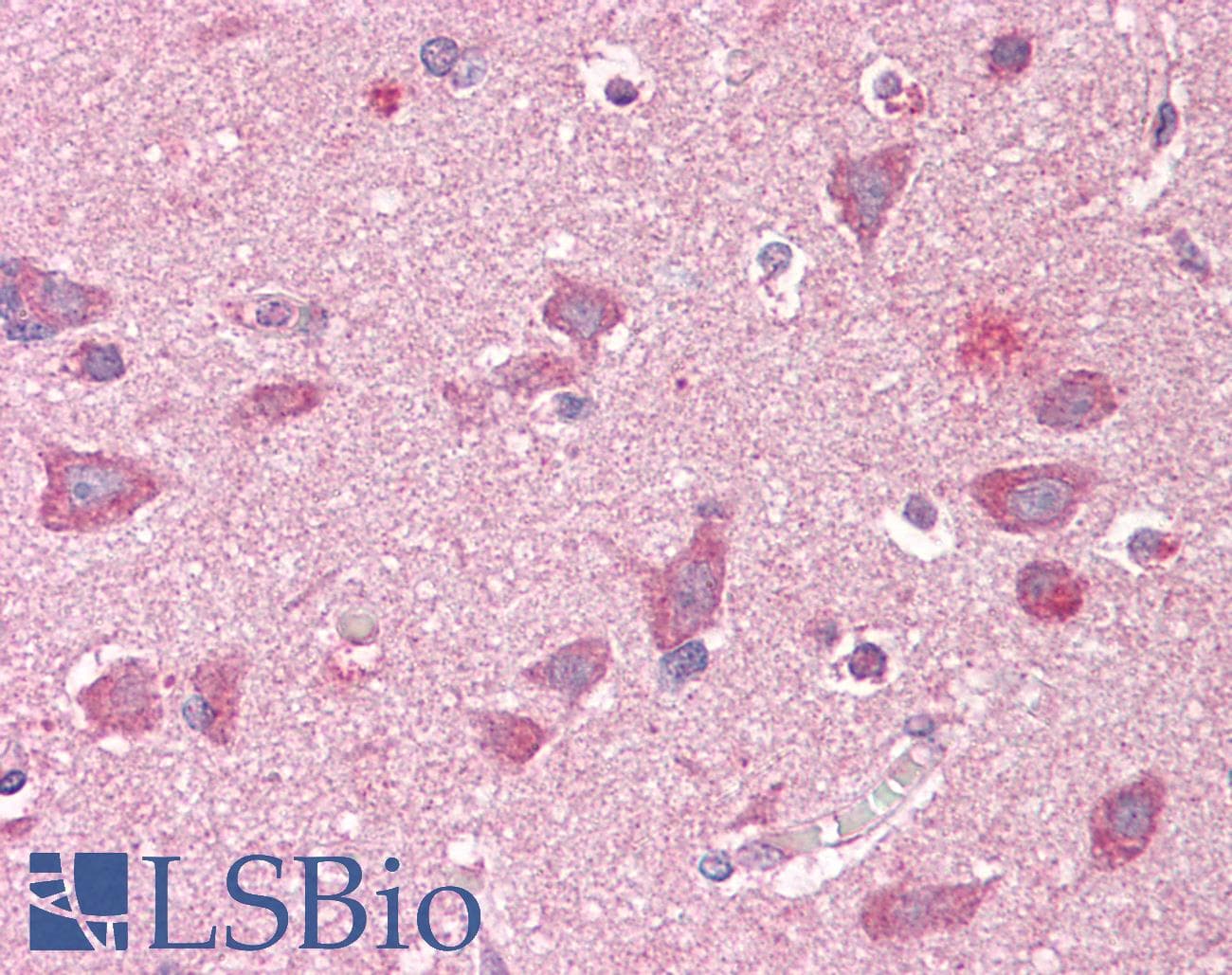 IHC-plus™ GRIPAP1 / GRASP1 Antibody (aa359-371)