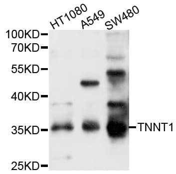 TNNT1 / TNT Antibody