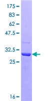 Human TWIST1 / TWIST Protein (Recombinant GST, N-terminus)