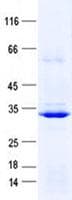 Human HOXC5 Protein (Recombinant His, N-Terminal)
