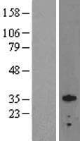 OTX2 Protein (Over-Expression Lysate Myc-DDK (Flag))