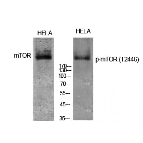 Polyclonal Rabbit anti-Human MTOR Antibody (2390-2470 aa, WB)
