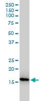 NUDT2 Antibody (clone 4A4-3C3)