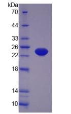 Mouse TNF Alpha Protein (Recombinant His, N-Terminal)