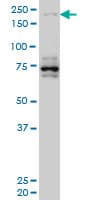 HELZ Antibody (clone 5B2)