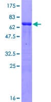 Human PARVA Protein (Recombinant GST)