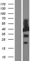 MAPRE2 / EB2 Protein (Over-Expression Lysate Myc-DDK (Flag))