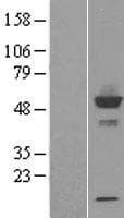 Human CYP-M / CYP20A1 Protein (Over-Expression Lysate Myc-DDK (Flag))