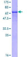 Human NDRG4 Protein (Recombinant GST)
