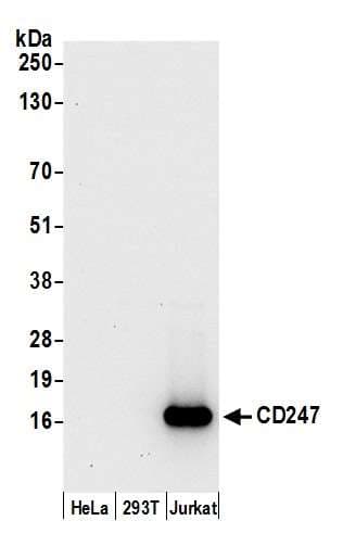 Polyclonal Rabbit anti-Human CD247 / CD3 Zeta Antibody (aa114-164, WB)