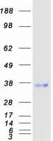 Human FSTL1 Protein (Recombinant Myc-DDK (Flag))