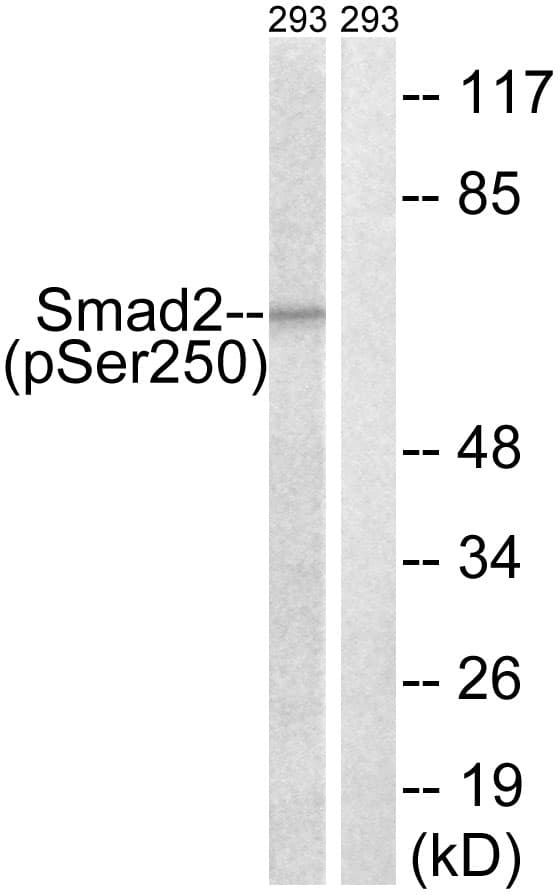 SMAD2 Antibody (phospho-Ser250)