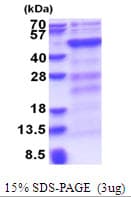 Human DNMT3L Protein (Recombinant His)