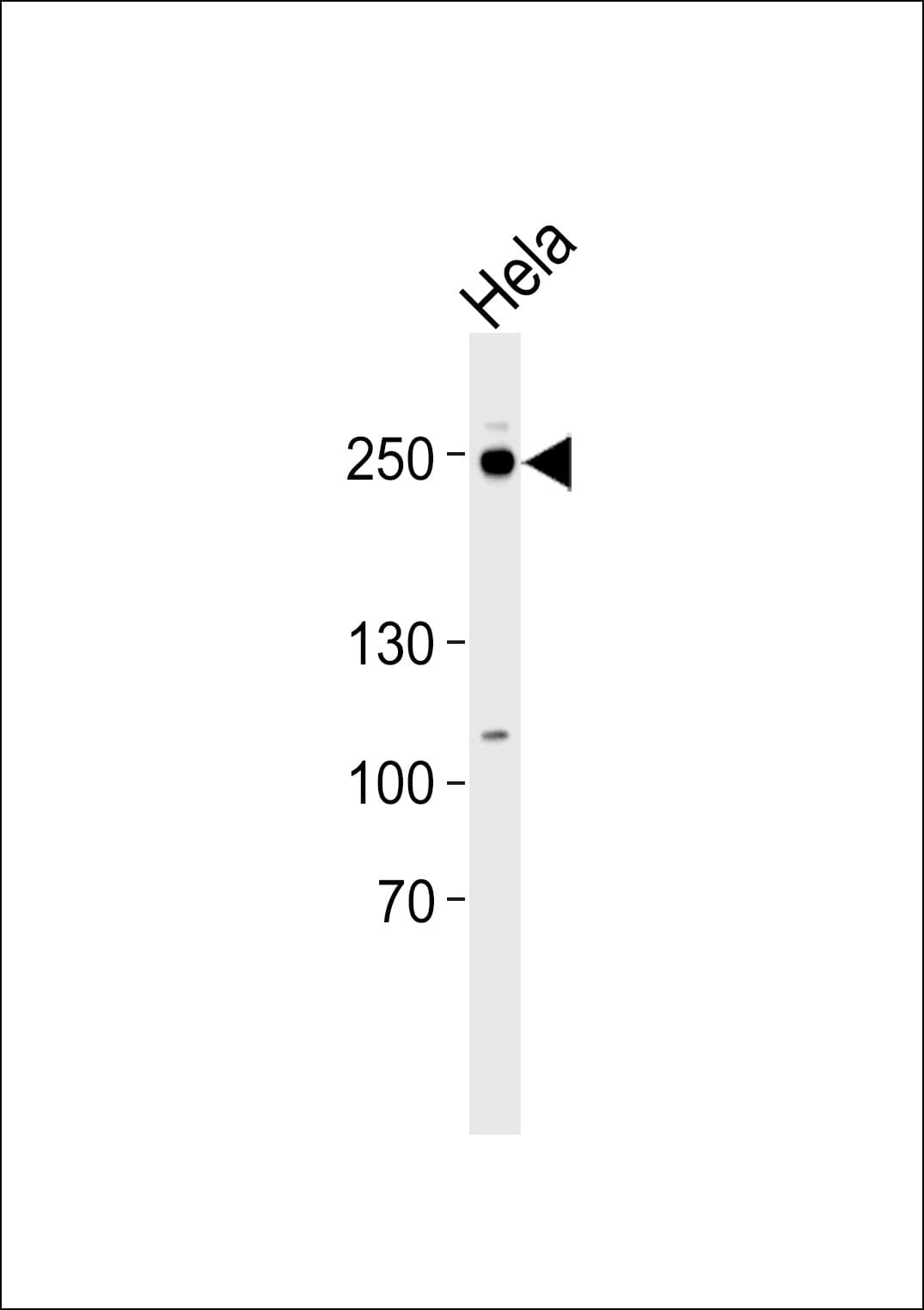 RSF1 / RSF-1 Antibody (aa1355-1389)