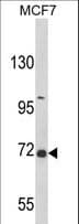 Polyclonal Rabbit anti-Human GAB2 Antibody (aa3-30, WB)