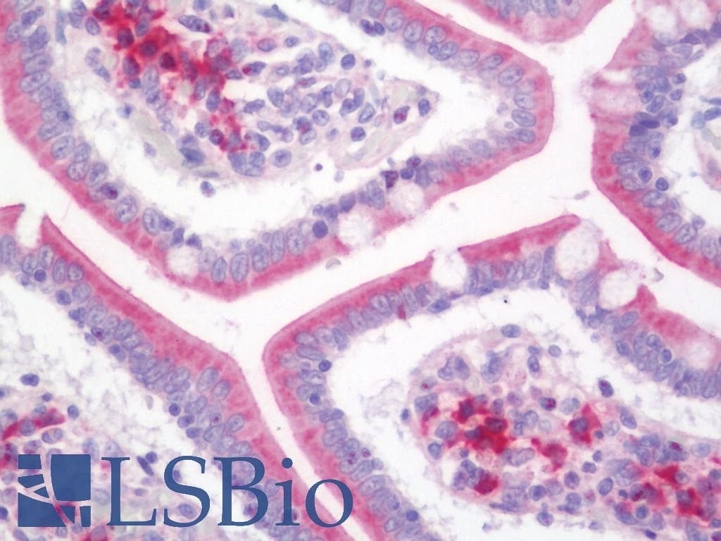 IHC-plus™ HSP90B1 / GP96 / GRP94 Antibody (aa460-487)