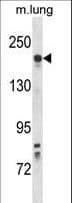 KDR / VEGFR2 / FLK1 Antibody (aa920-949)