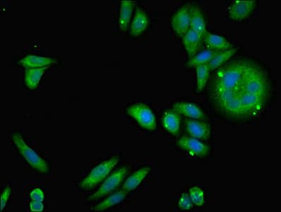 NDUFA12 / B17.2 Antibody