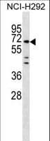 MIER3 Antibody (aa284-312)