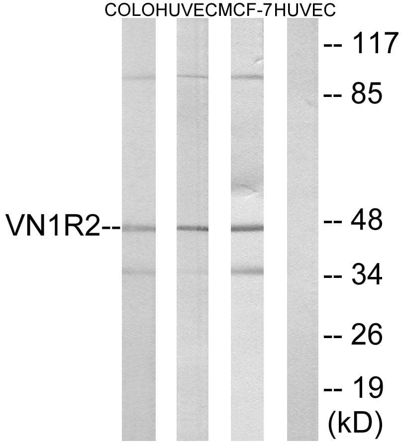 Polyclonal Rabbit anti-Human VN1R2 Antibody (WB)