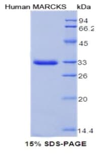 Human MARCKS Protein (Recombinant His, N-Terminal)