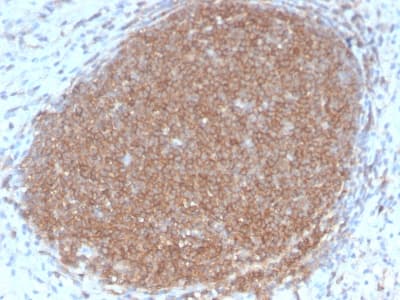 CD45RB Antibody (clone PTPRC/2877R, Azide-free, Carrier-free)