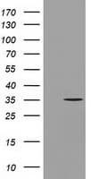 GGPS1 Antibody (clone OTI3F9)