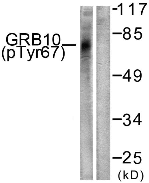 GRB10 Antibody (phospho-Tyr67)