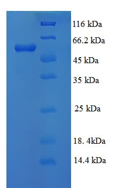 Human LOXL1 Protein (Recombinant 6His, N-terminus)