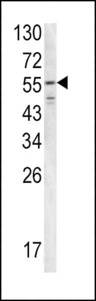 FGB / Fibrinogen Beta Chain Antibody (aa29-58)