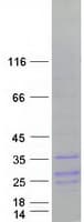 Human IFN Gamma / Interferon Gamma Protein (Recombinant Myc-DDK (Flag))