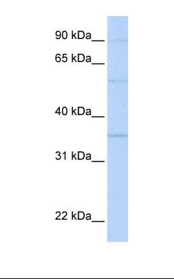 Polyclonal Rabbit anti-Human Prohibitin 2 / PHB2 Antibody (aa74-123, WB)