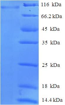 Human PAD2 / PADI2 Protein (Recombinant His-SUMO)