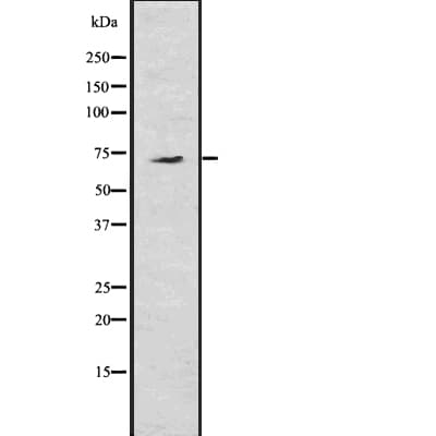 Polyclonal Rabbit anti-Human GP78 / AMFR Antibody (IHC, WB)