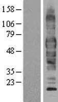 Human SLC1A1 / EAAT3 Protein (Over-Expression Lysate Myc-DDK (Flag))