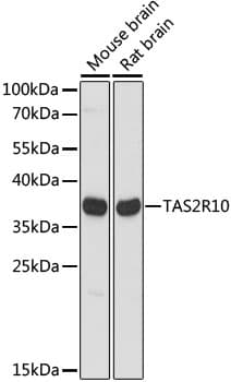 TAS2R10 / TRB2 Antibody