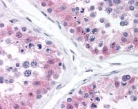 MAPK1 / ERK2 Antibody (clone Poly6242)